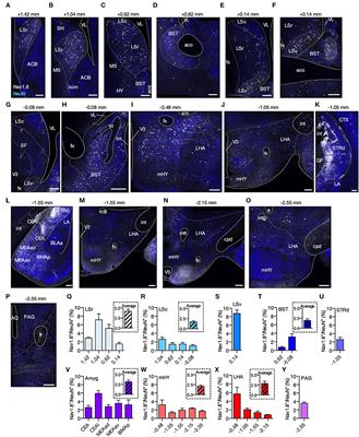 Transiently Nav1.8-expressing neurons are capable of sensing noxious stimuli in the brain